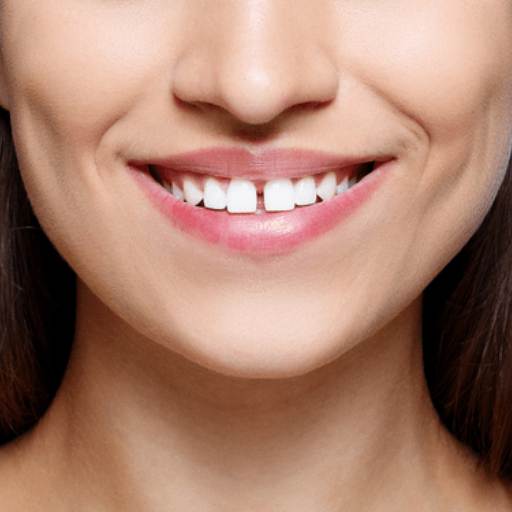 https://d-morph.com/wp-content/uploads/2022/11/teethGap.jpg